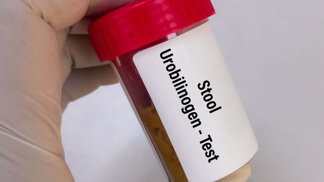 stool sample test
