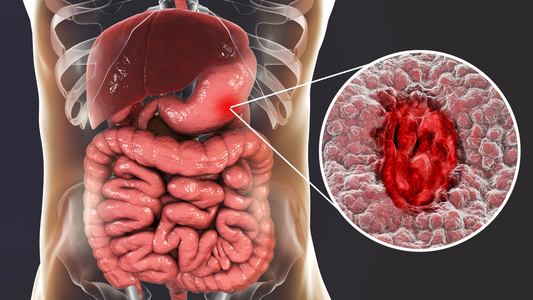 leaky gut repair
