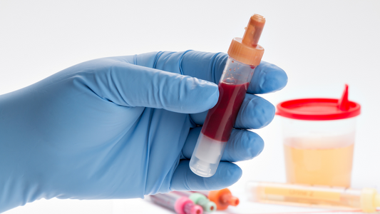 mycotoxin testing