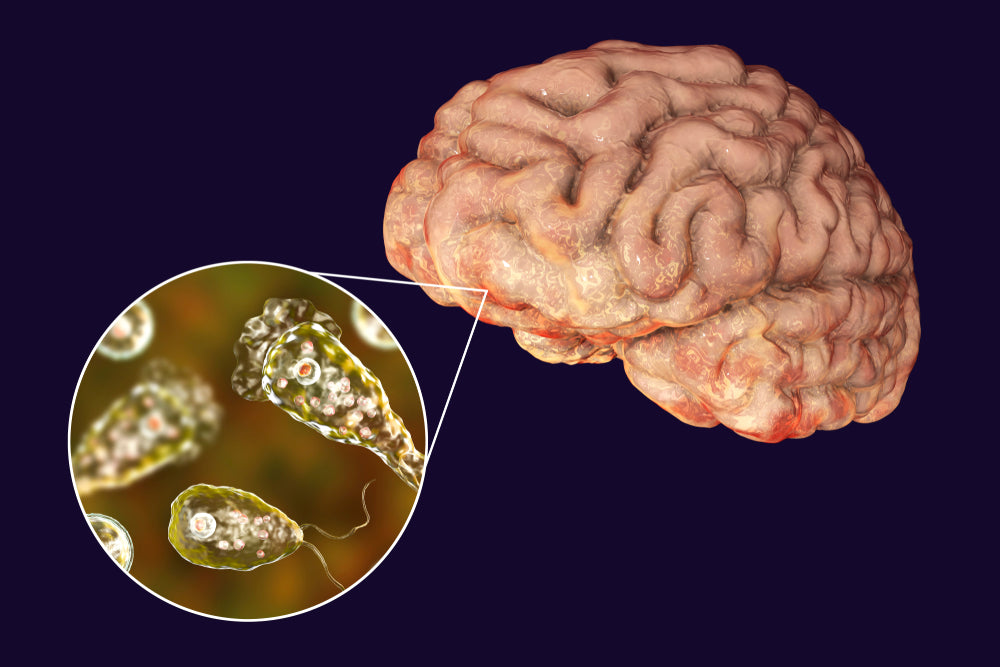 parasites in brain
