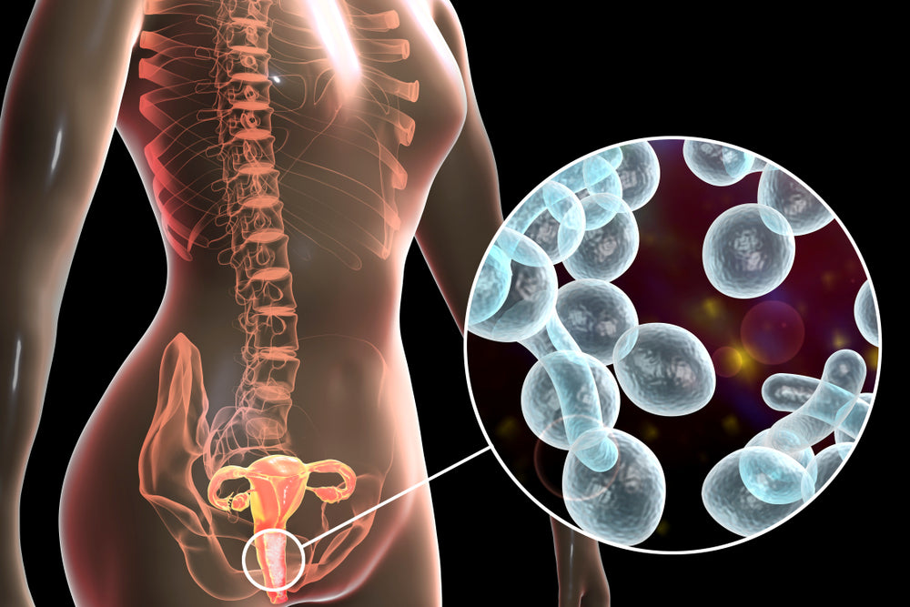 Does Amoxicillin Cause Yeast Infections?