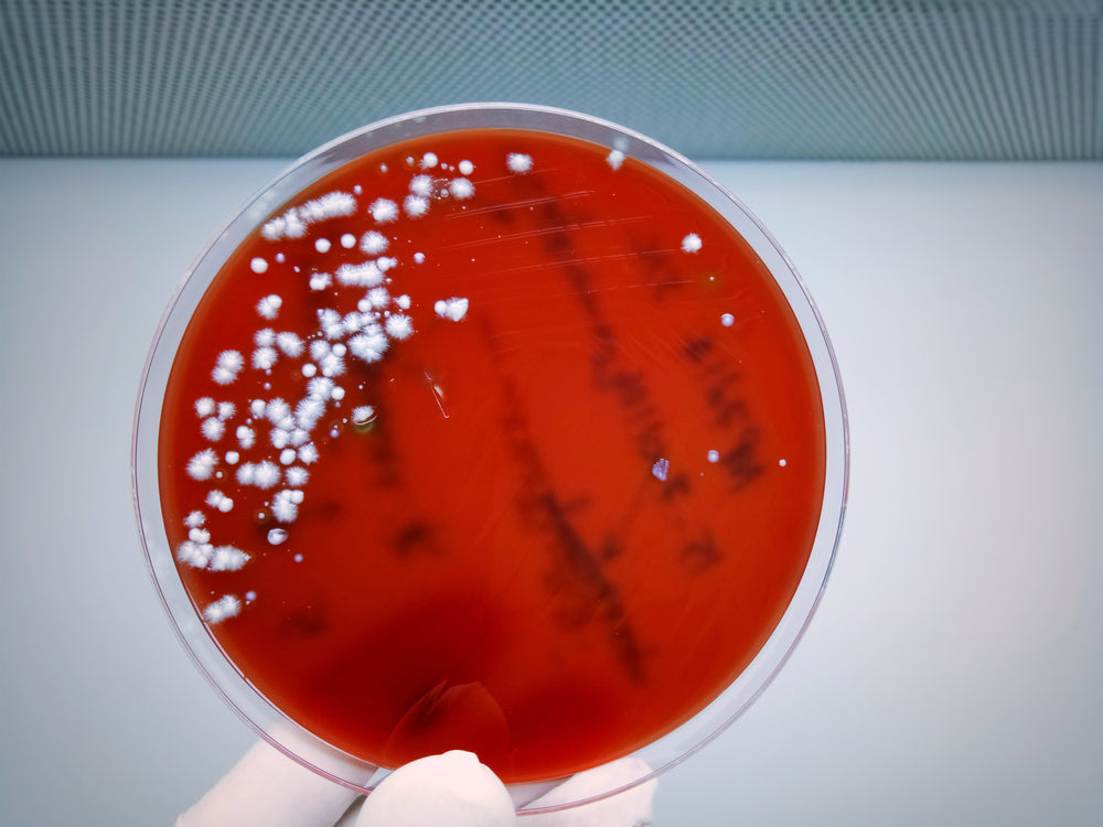 Everything You Need to Know About Candida Testing