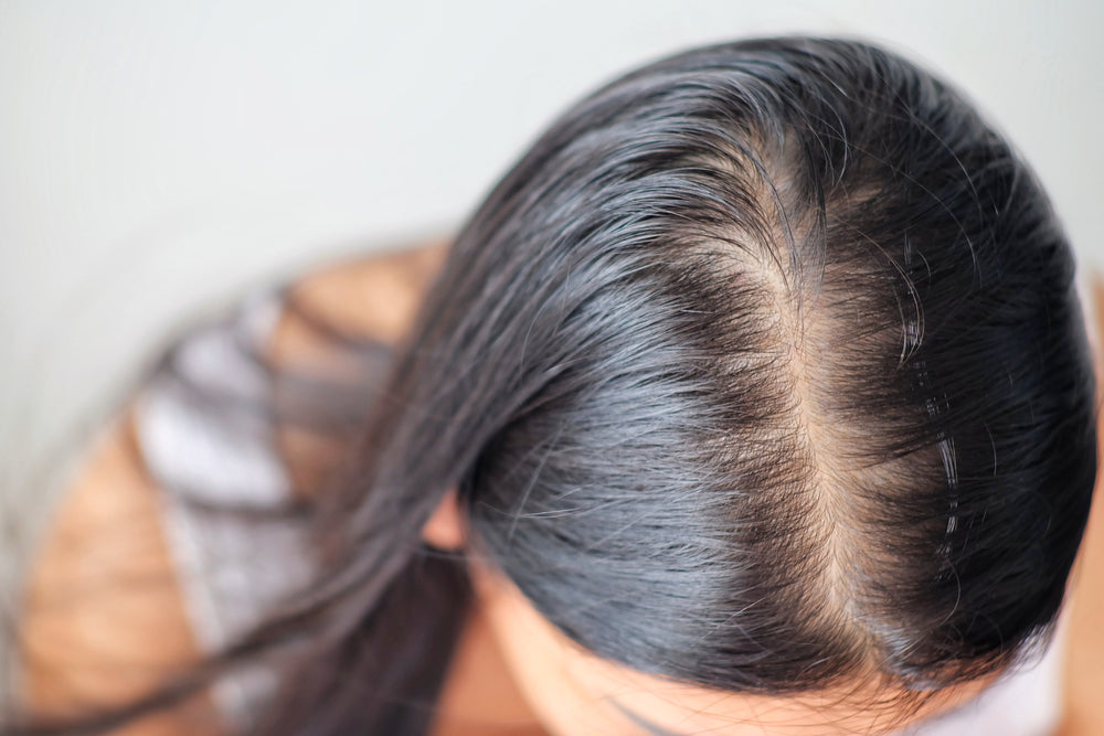 Best Shampoo for Hair Loss