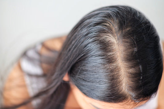 Best Shampoo for Hair Loss