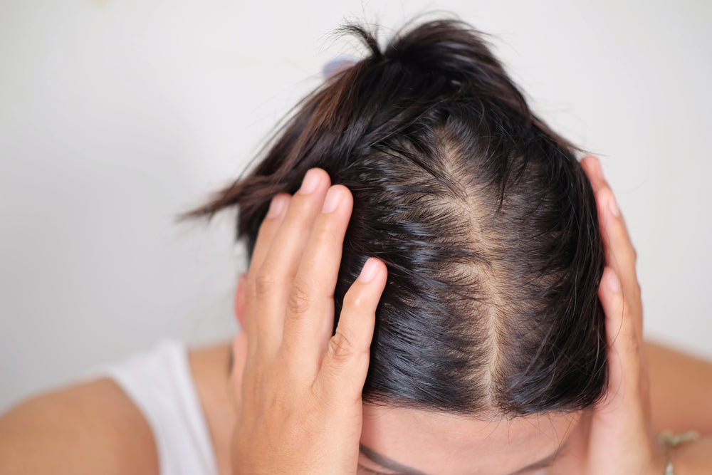 hair thinning