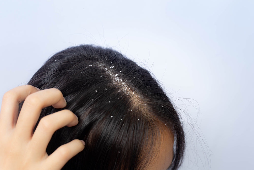 How to Use Honey on Your Scalp  Gisou