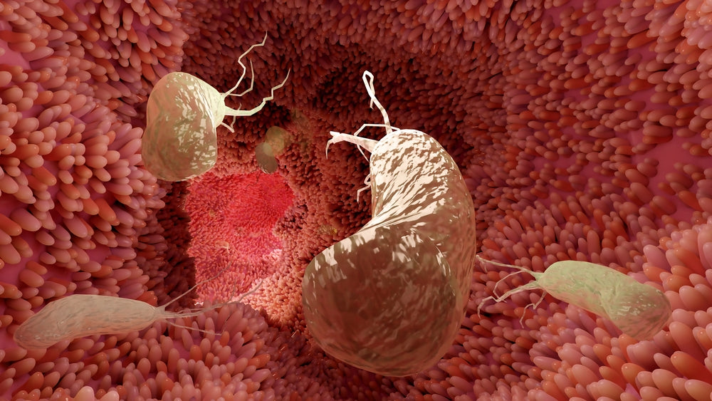 H Pylori Symptoms, Signs and Natural Treatment