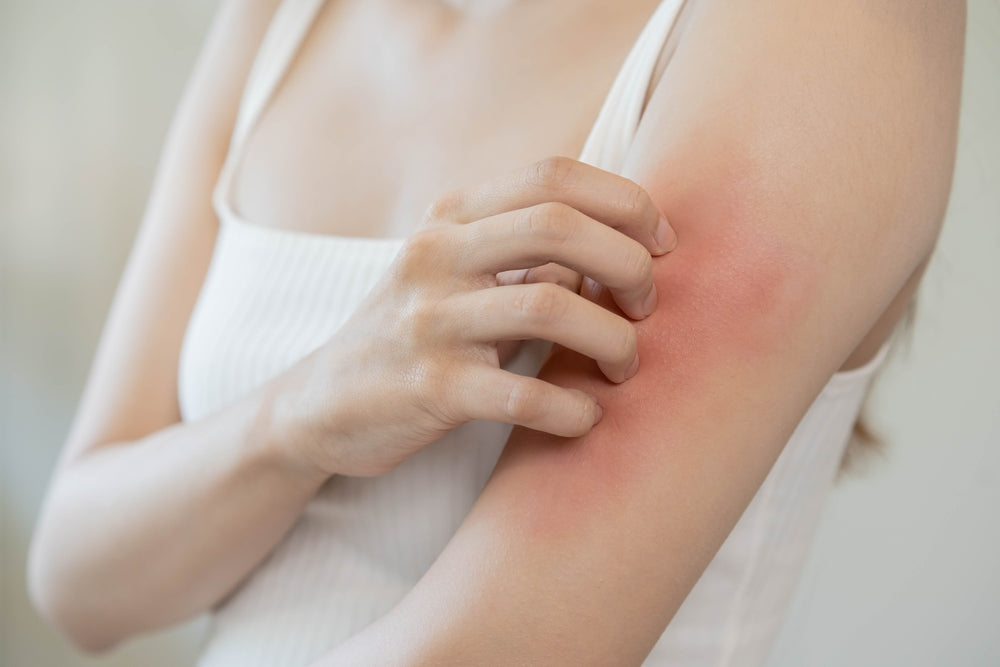black mold skin rash