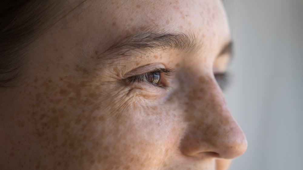 Natural Alternatives to Sunscreen