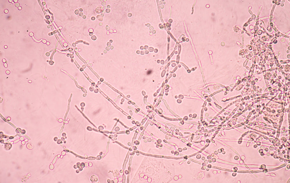budding yeast cells with pseudohyphae in urine sample fine with microscope.