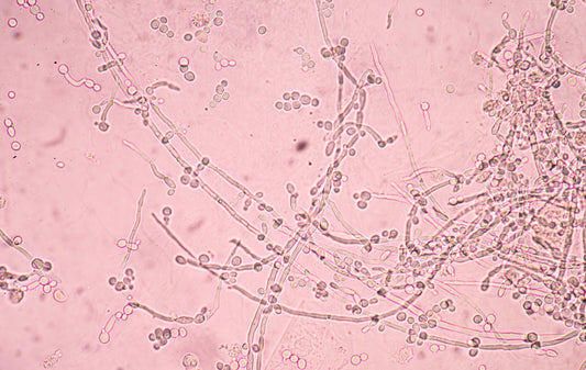 budding yeast cells with pseudohyphae in urine sample fine with microscope.