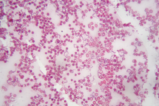 Microscope photo of human blood with Trypanosoma brucei